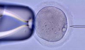 IVF fertilization