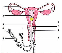 Hormonbehandlung