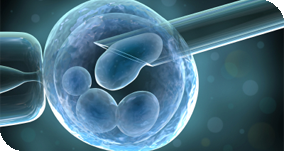 IUI